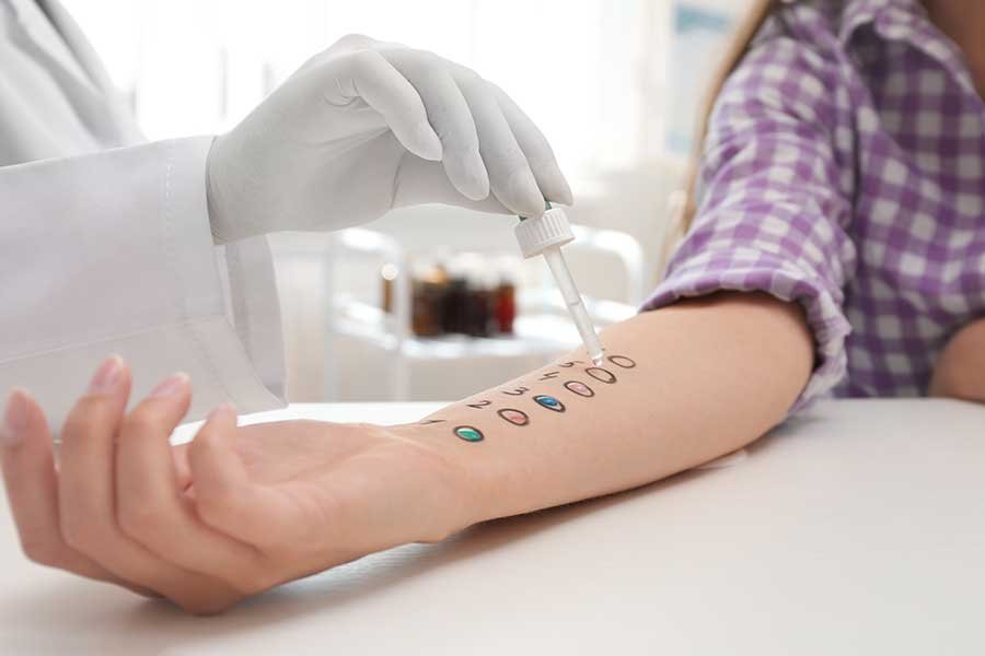 Allergy Testing Services